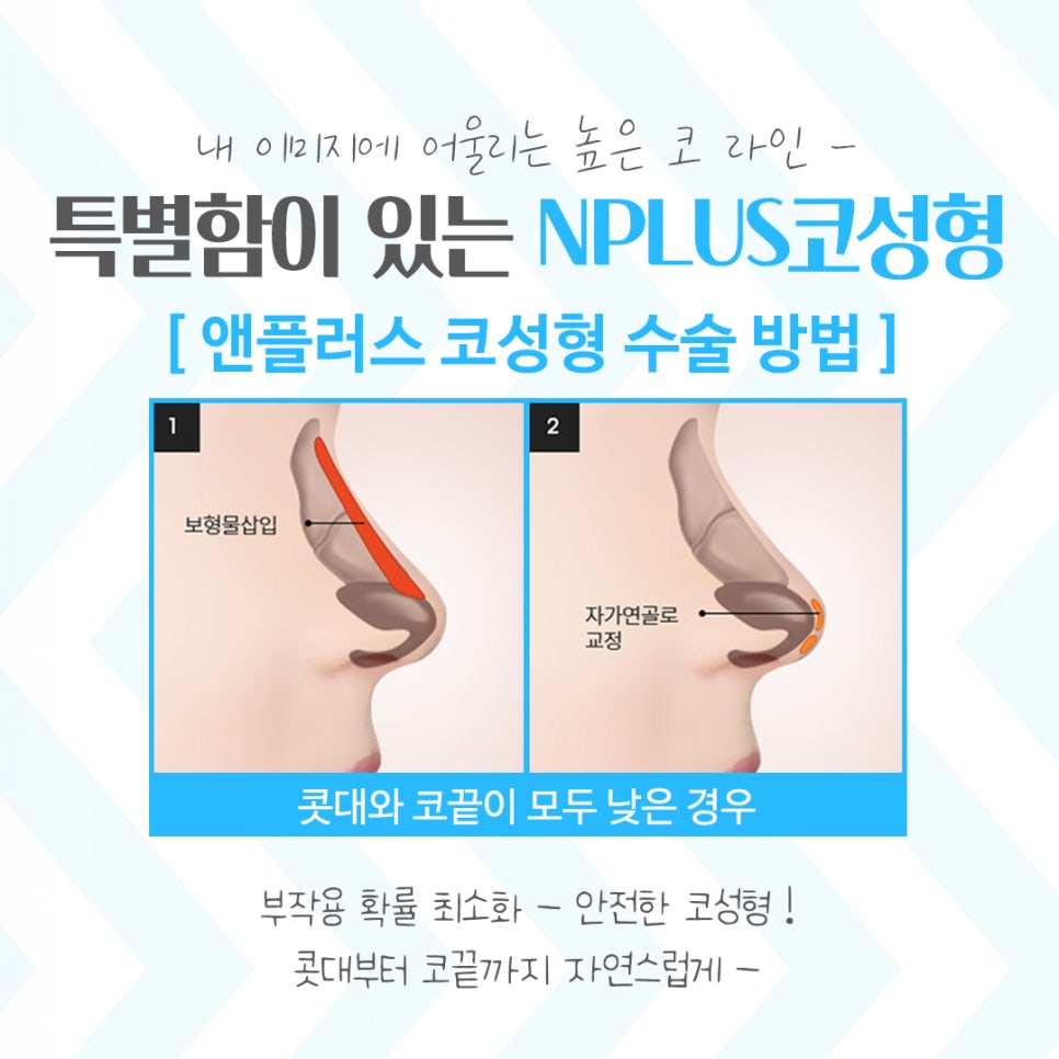코성형잘하는곳에서 차이를 알아보고 관련 이미지 8