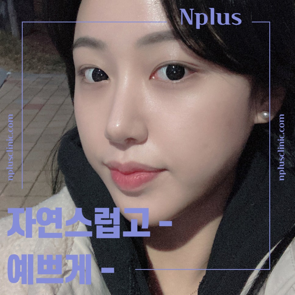코성형후기 이미지를 예쁘고 자연스럽게 관련 이미지 2