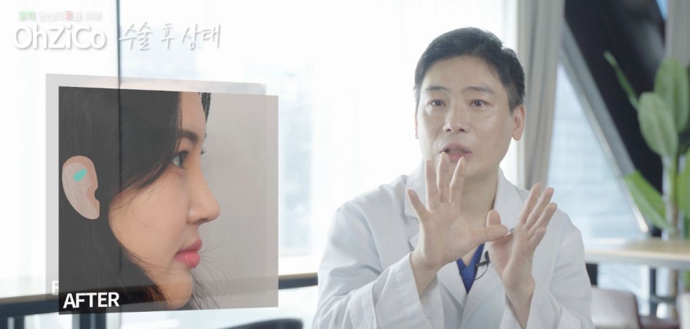 짧은코수술 후기까지 자세하게 알아보고 관련 이미지 7