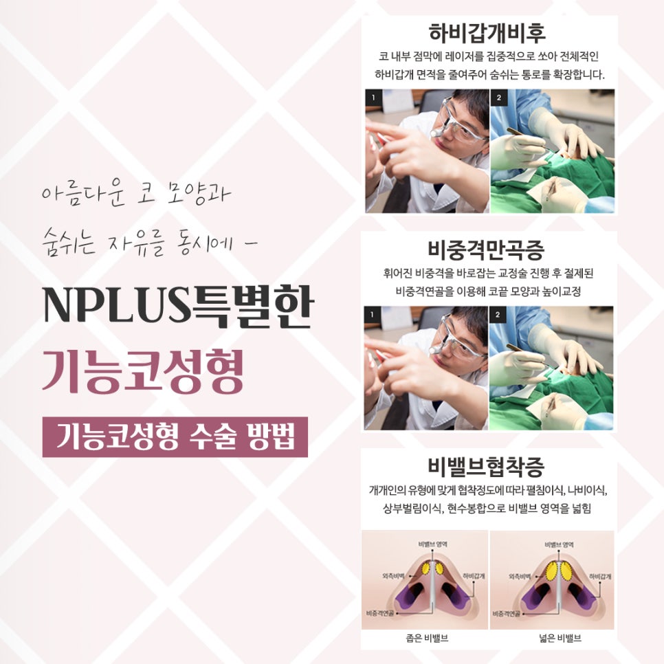 한쪽코막힘을 해결하는 방법 관련 이미지 8