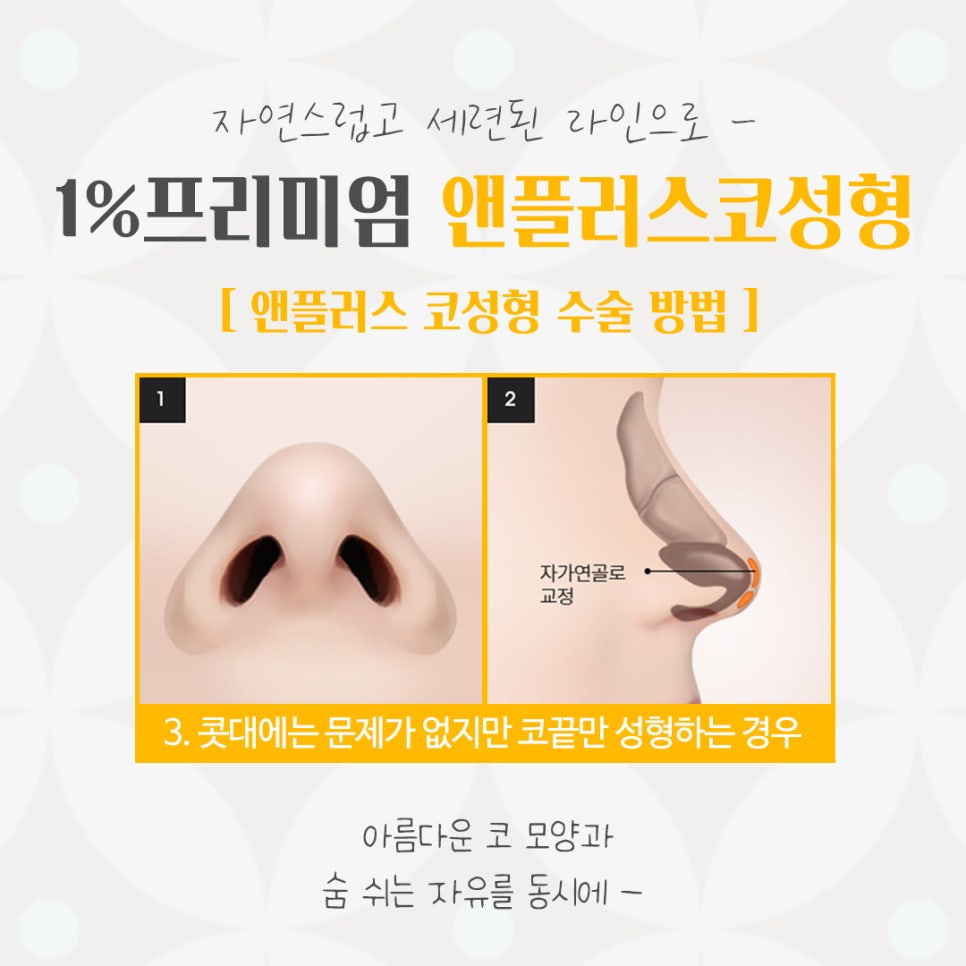 자가늑연골코성형의 필요성 관련 이미지 10