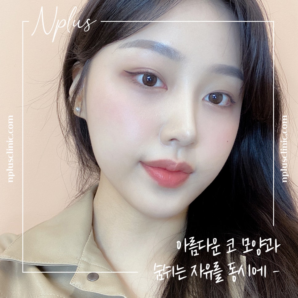콧볼축소수술후기 내게 어울리는 라인으로 관련 이미지 7
