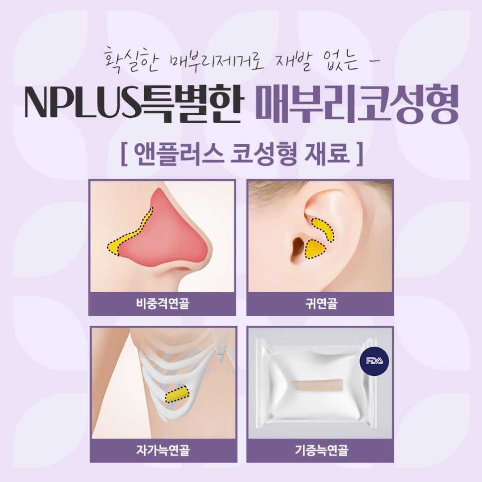 Check the Hump Nose Surgery Review in Detail image 12