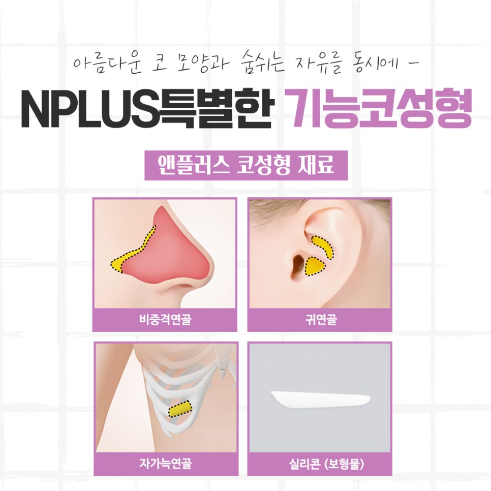 코성형후기 자연스럽고 아름답게 관련 이미지 9