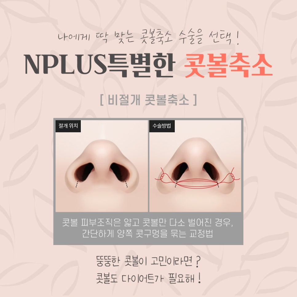 A Review of Nostril Reduction Surgery for a More Refined Look image 8