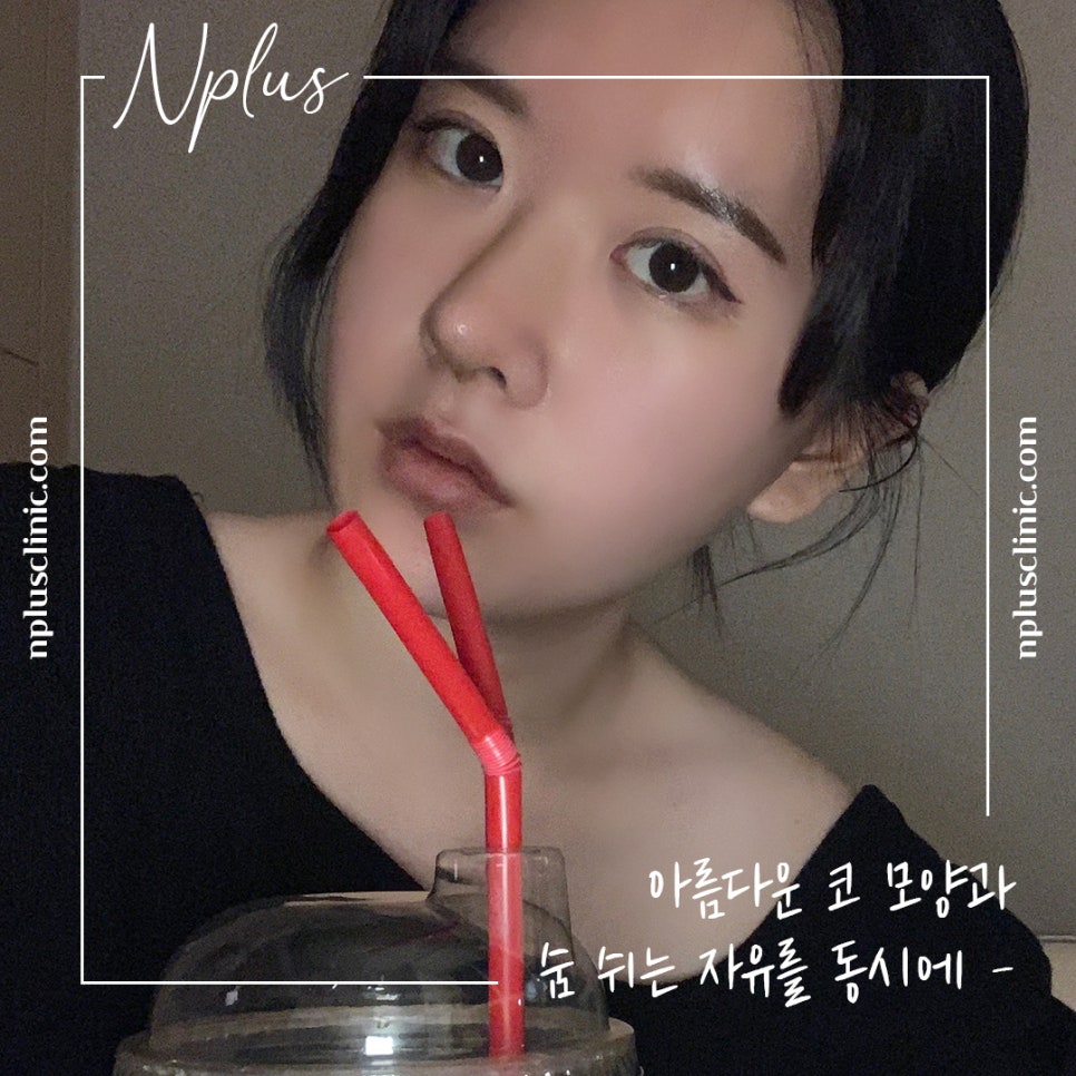 코수술후기 라인까지 고려해서 관련 이미지 14