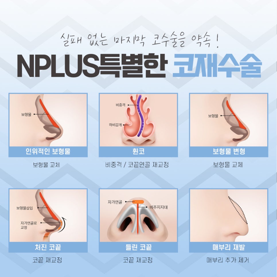 Carefully Check the Revision Rhinoplasty Hospital image 6