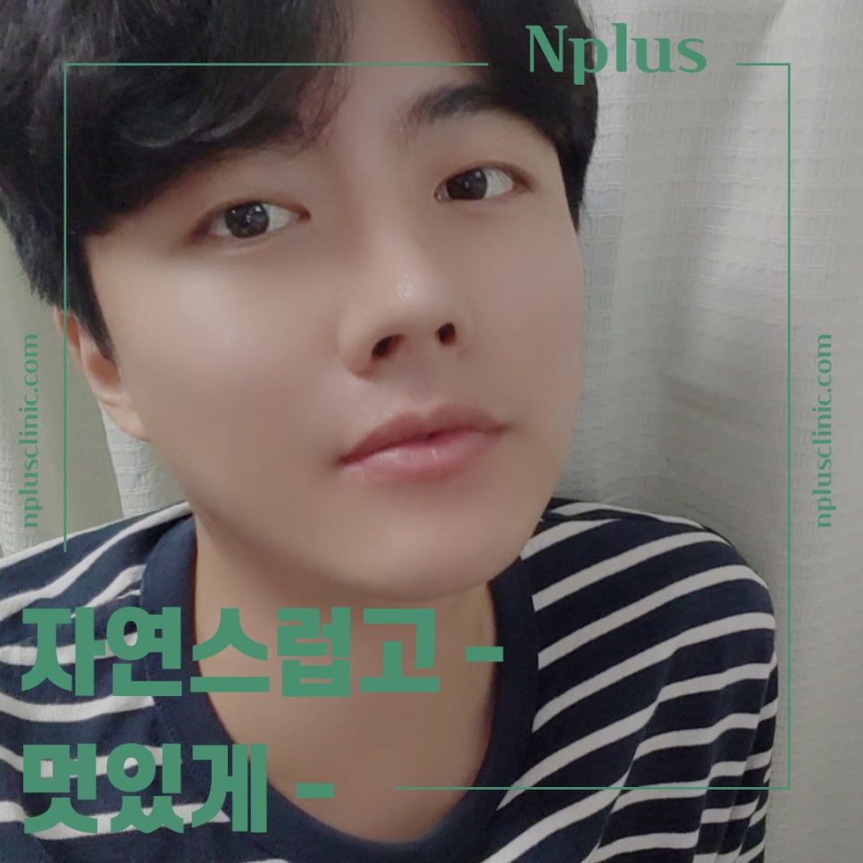 남자성형 잘 판단하고 결정 관련 이미지 4