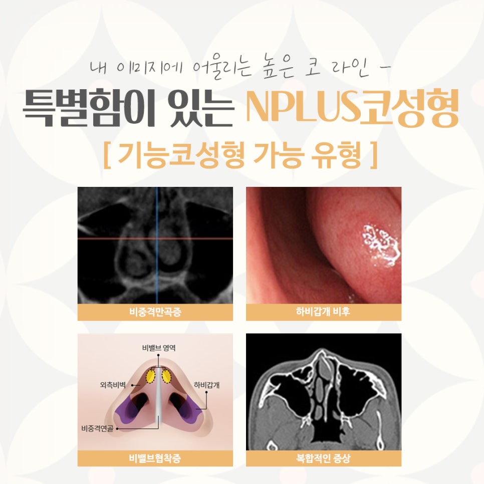 If You’re Looking for a Place That Does Rhinoplasty Well! image 4