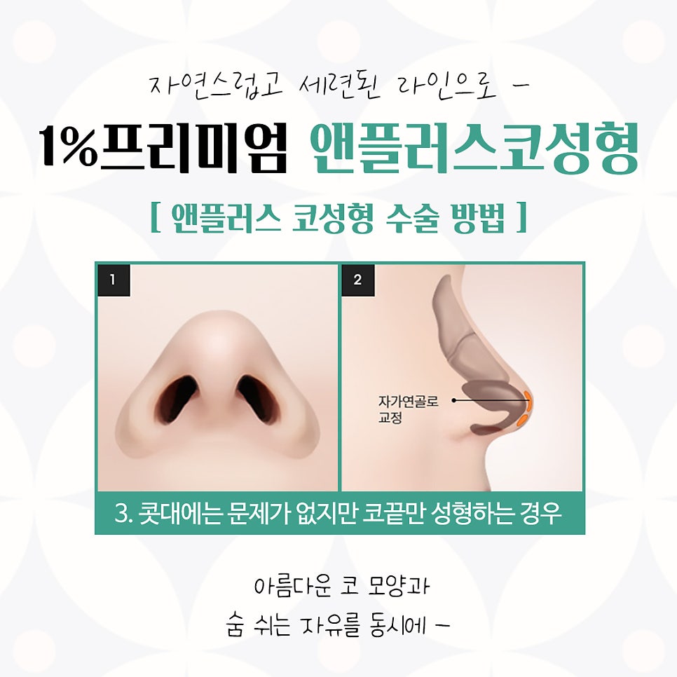 Learn About Autologous Rib Cartilage Nose Surgery Accurately image 11