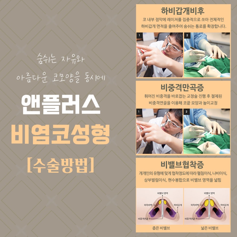 The Importance of Choosing a Rhinoplasty Review for Rhinitis image 8