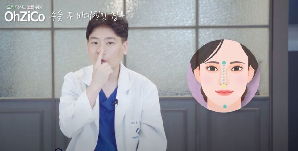 콧구멍비대칭 짝짝이에 대한 내용 정리! 관련 이미지 8