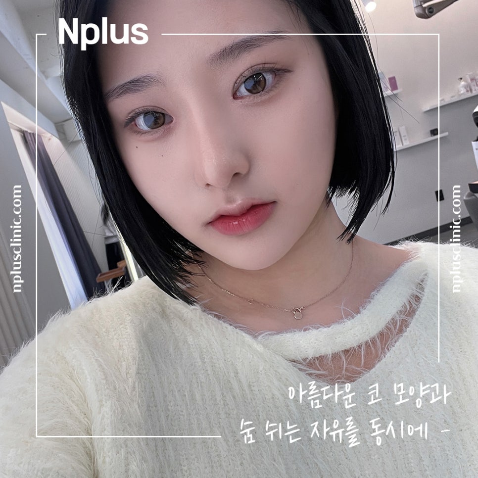코수술전후 자연스러운 라인으로 관련 이미지 12