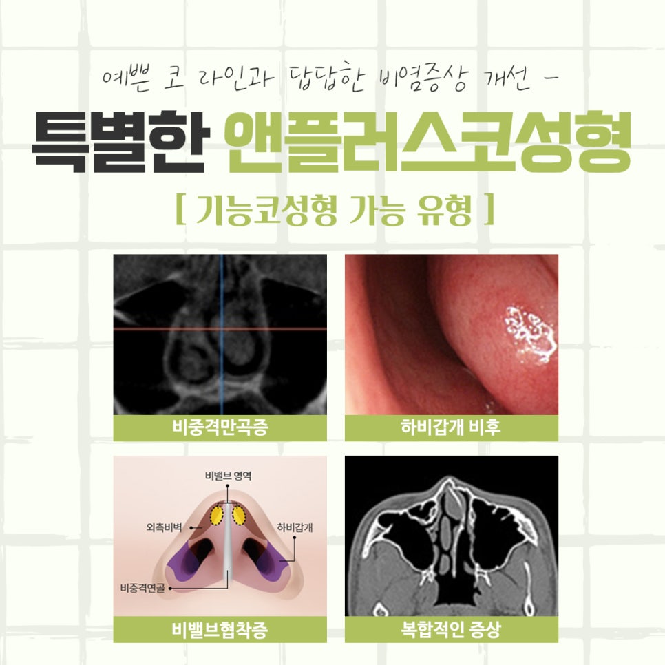 강남코성형에 대해 자세하게 알아보고 관련 이미지 5