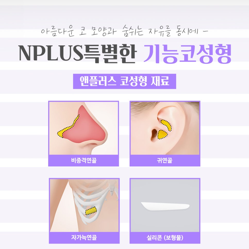 기능코성형후기 꼼꼼하게 체크하고 관련 이미지 11