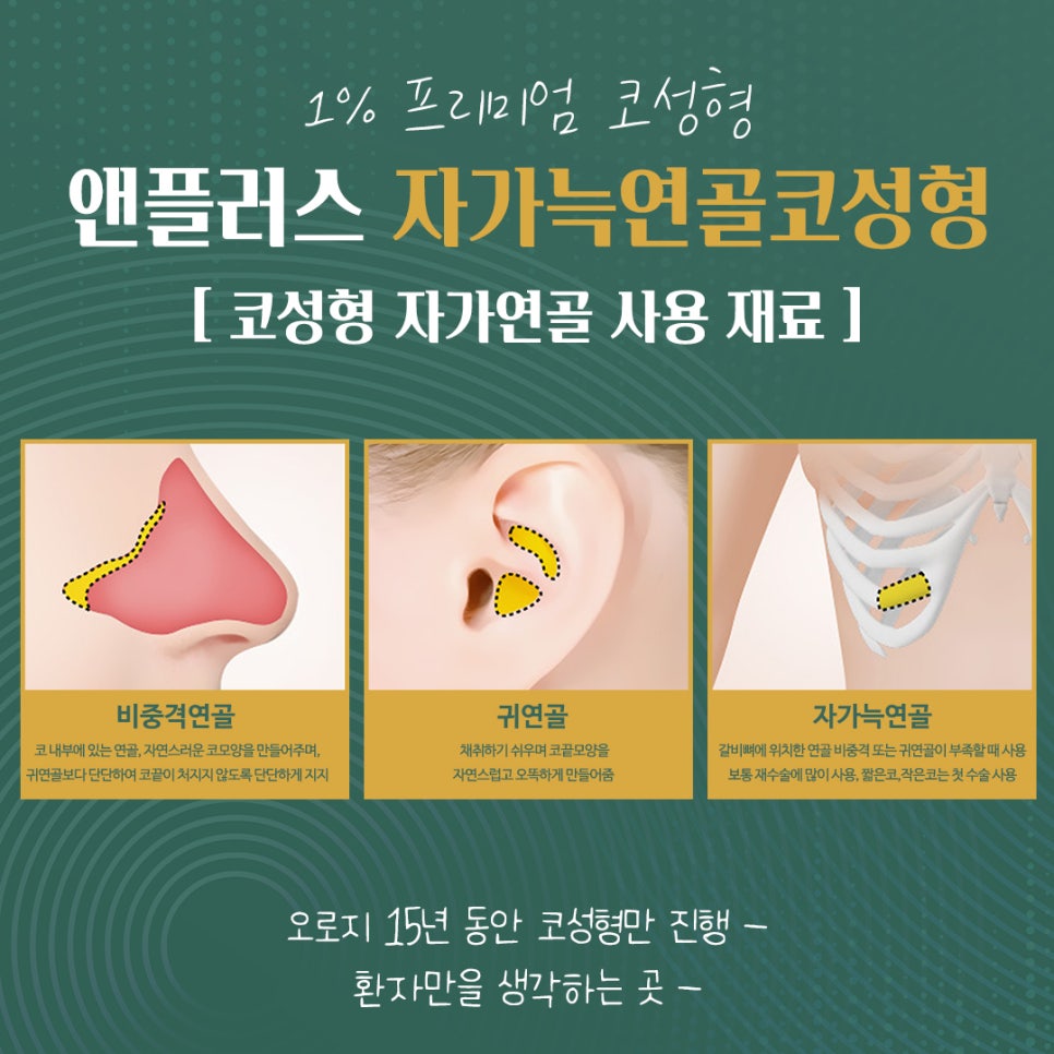 자가늑연골코수술로 처음부터 확실하게 관련 이미지 2