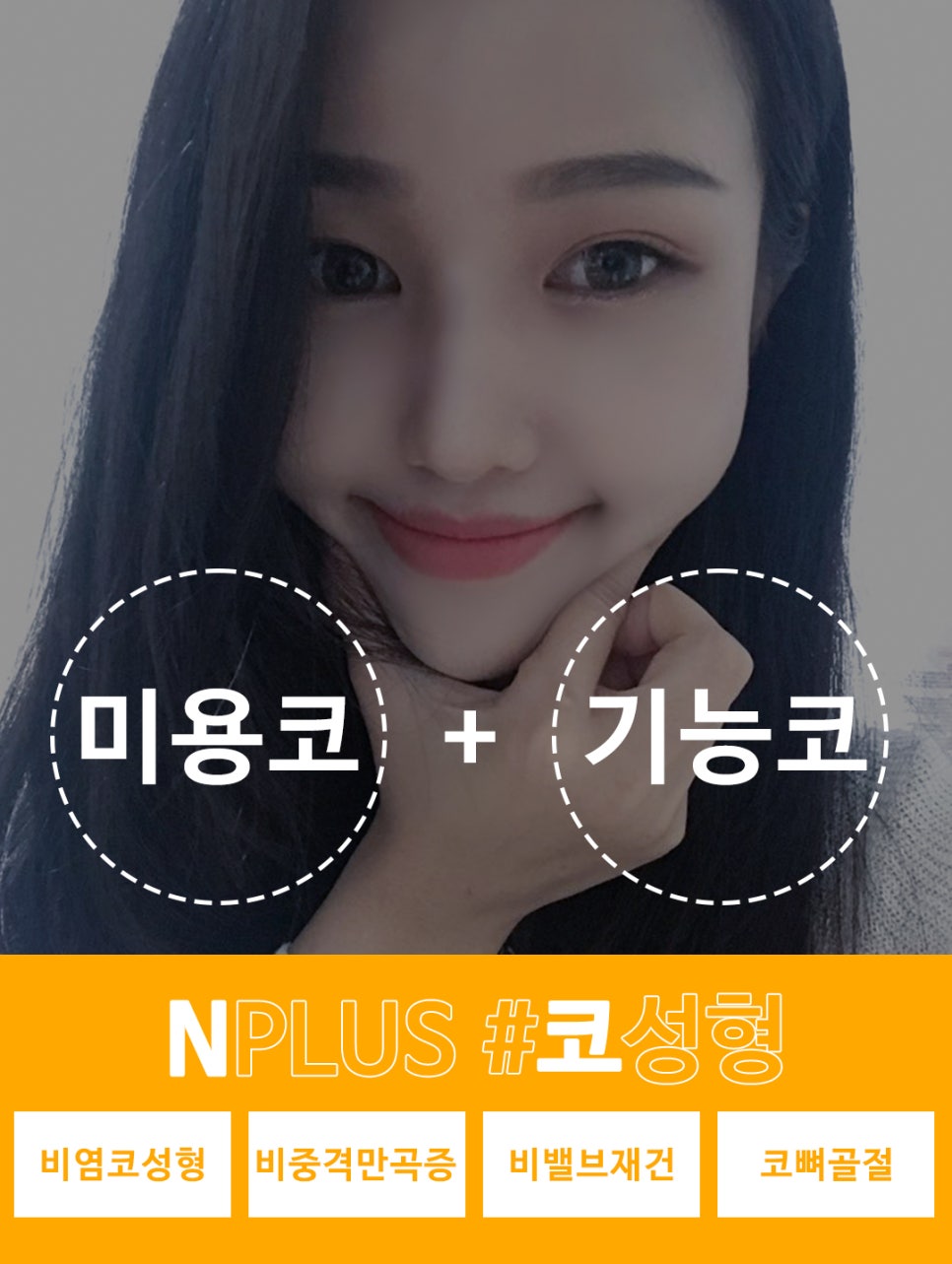 콧대수술_비염기능까지 고려해서 관련 이미지 8