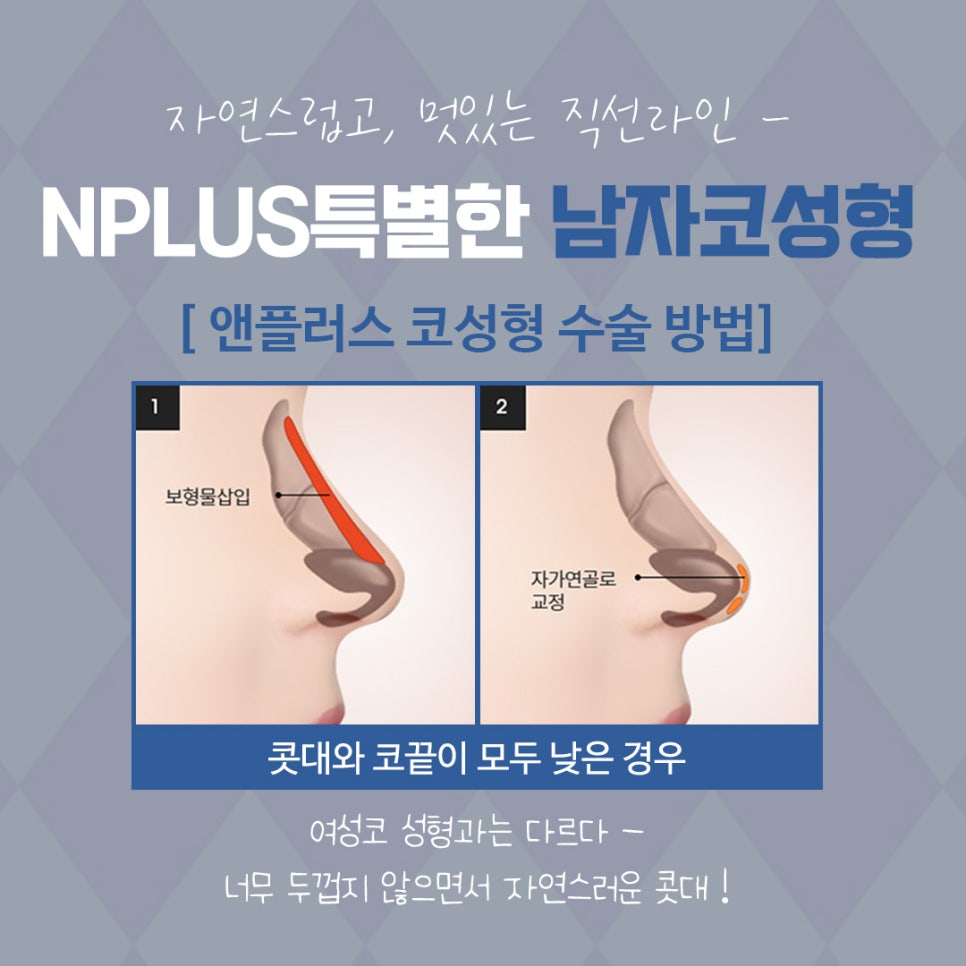 Where to Get Male Rhinoplasty Done Well: Natural and Refined image 9