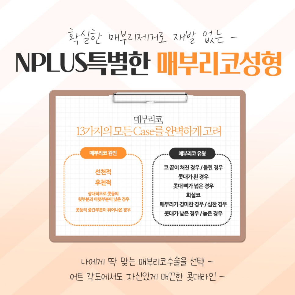 매부리코성형후기를 자세하게 알아보고 관련 이미지 4