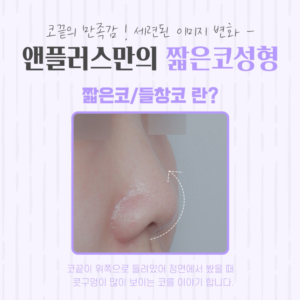 짧은코수술 후기까지 확실하게 관련 이미지 4