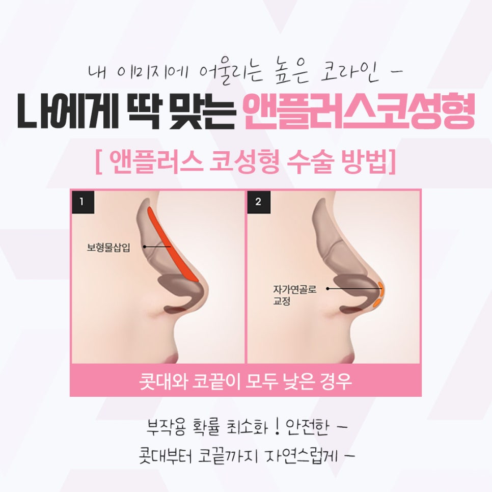 앤플러스의원에서 전해드리는 코성형후기 관련 이미지 7