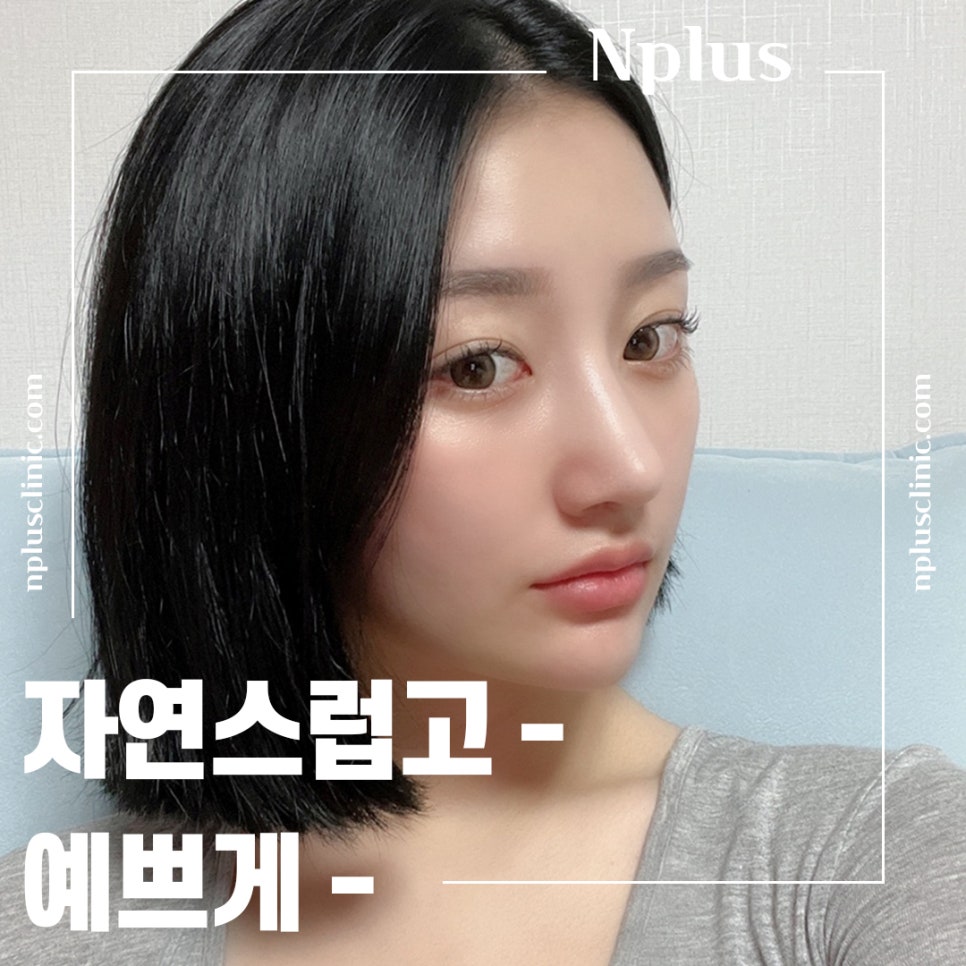 복코성형후기 코지방제거로 확실하게 관련 이미지 11