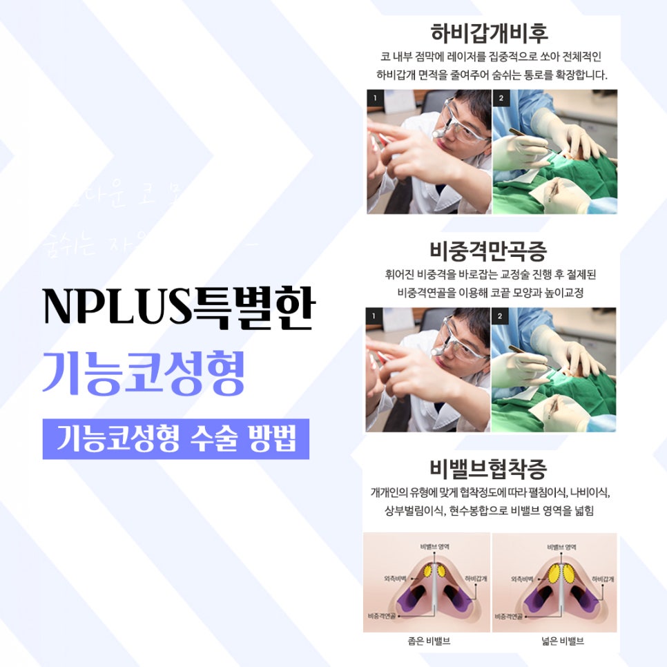 기능코성형후기 다양한 변화를 확인하여 관련 이미지 9