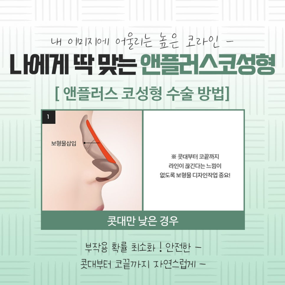 Check the Difference in Autologous Rib Nose Surgery Results image 9
