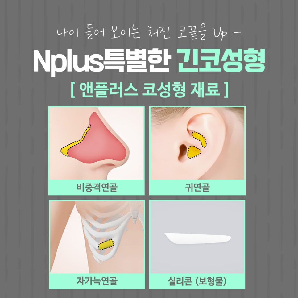 긴코수술 후기까지 확인하고 선택 관련 이미지 13