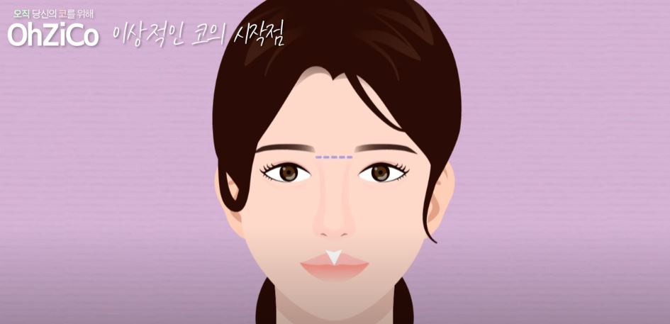 코성형 후 눈몰림 걱정된다면? 관련 이미지 19