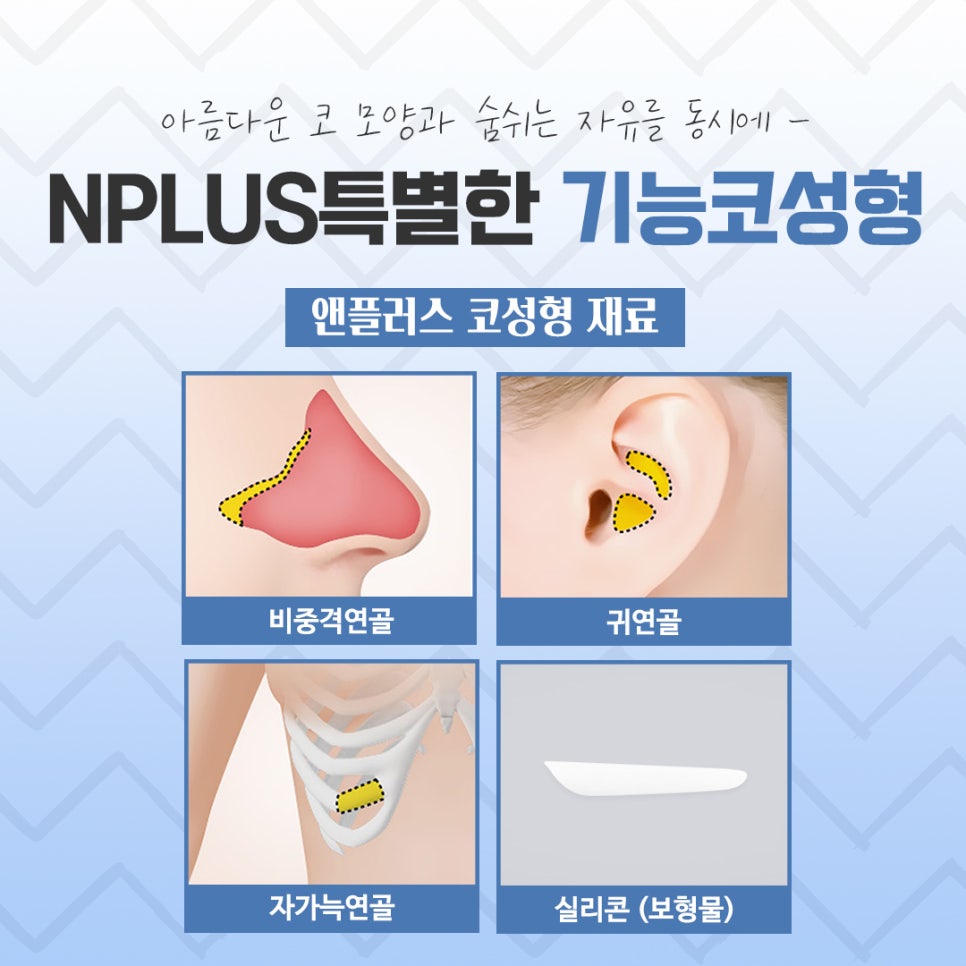비염수술전후 확실한 차이를 알아보고 관련 이미지 10