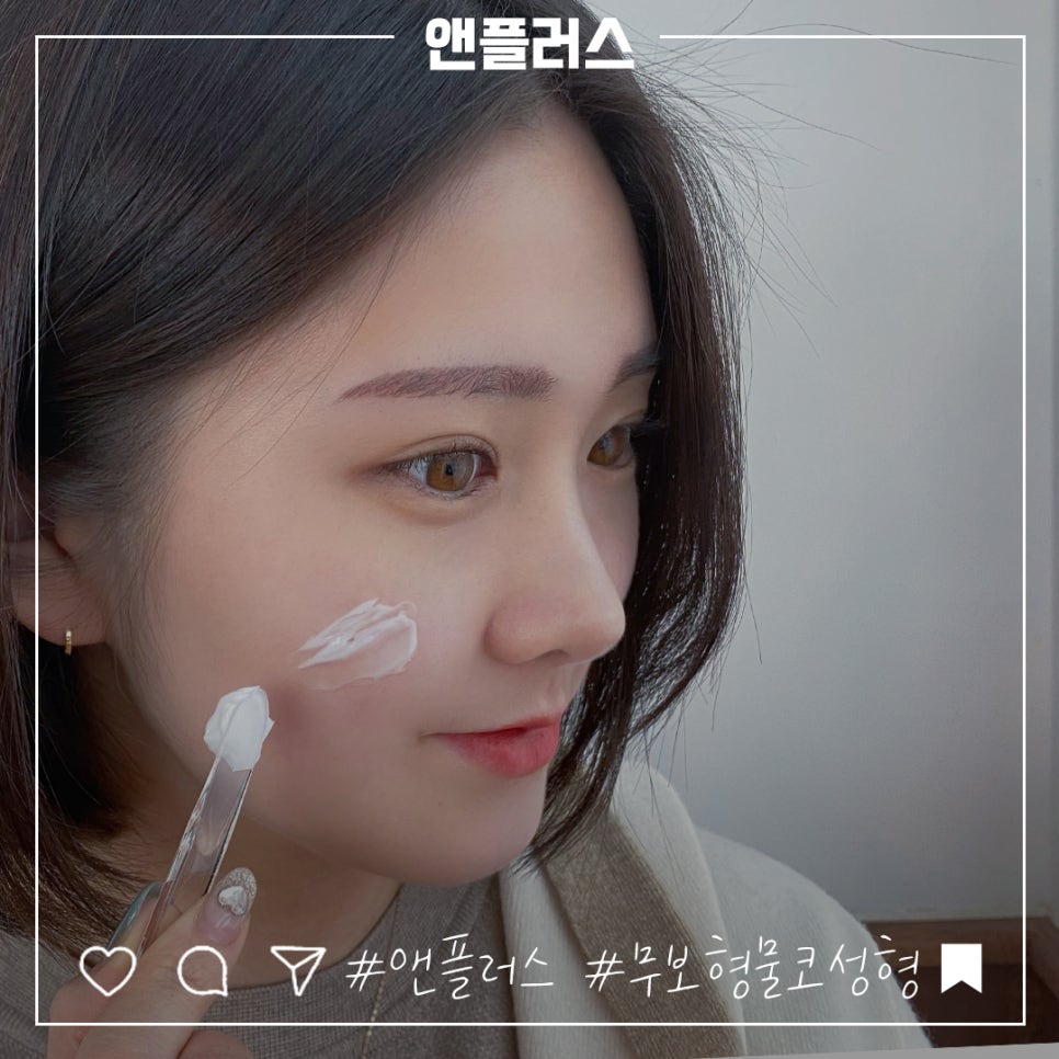 No-Implant Nose Surgery for a Natural Nose Line image 13