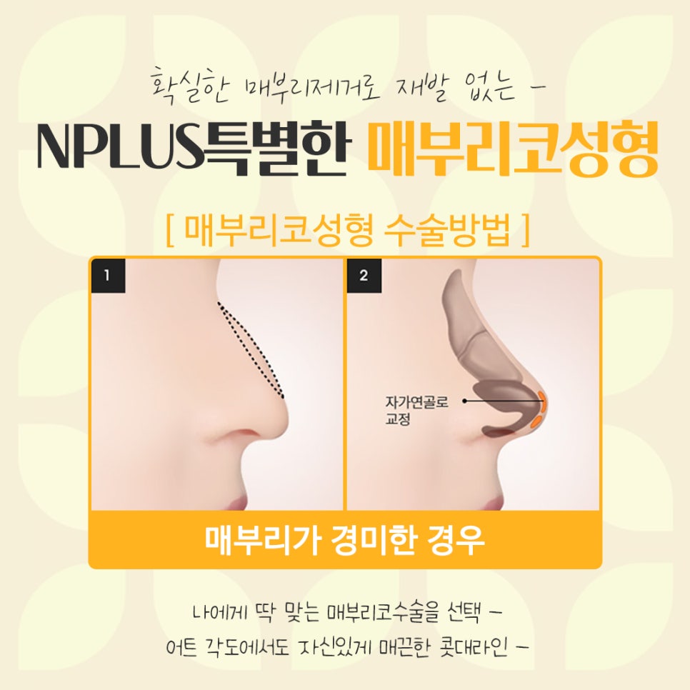Detailed Review of Hump Nose Surgery, Including Function image 10