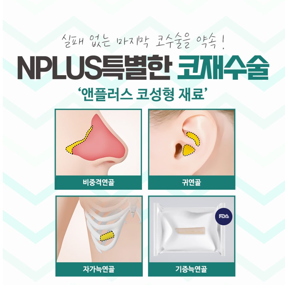 Male Nose Revision Surgery with a Thorough Diagnosis image 10