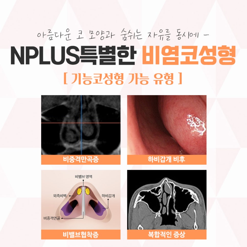 비염의원인과 해결 방법에 대해 관련 이미지 4