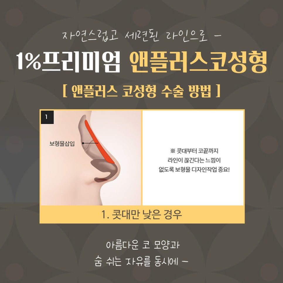 자가늑연골코성형으로 세련된 이미지로 변신 관련 이미지 8