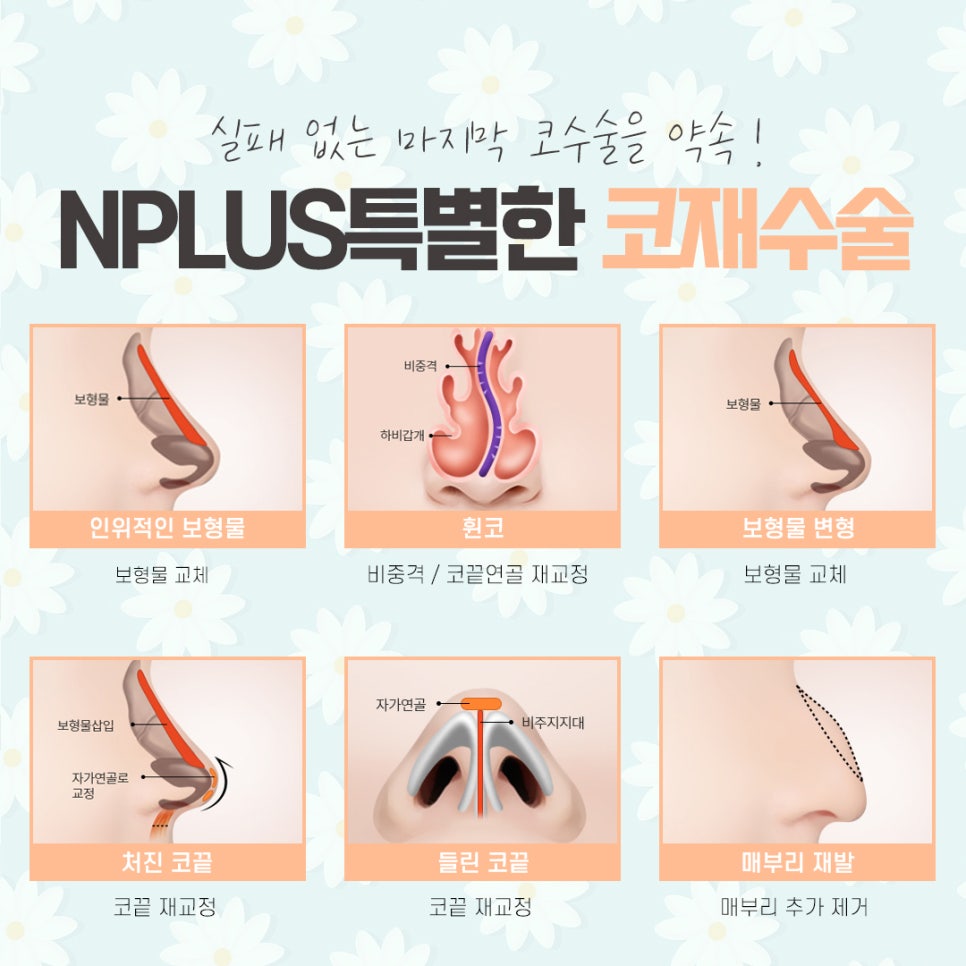 코재수술후기에 대해 자세하게 알아보고 관련 이미지 9