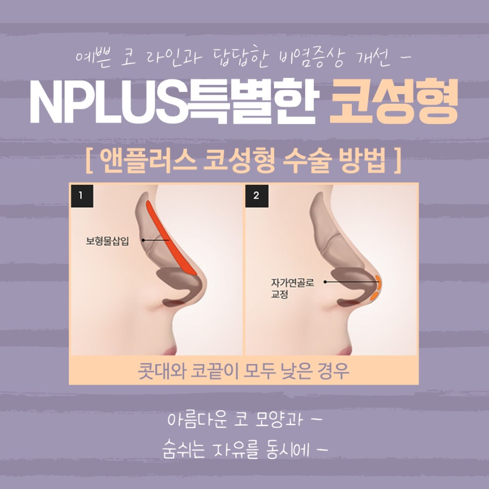 A Nose Surgery Review That Accurately Checks Function Too image 9