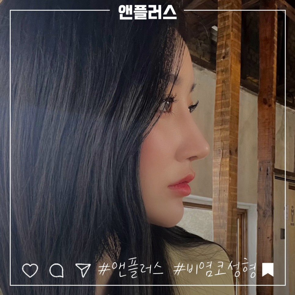 비염코성형후기 라인까지 고려하여 관련 이미지 5