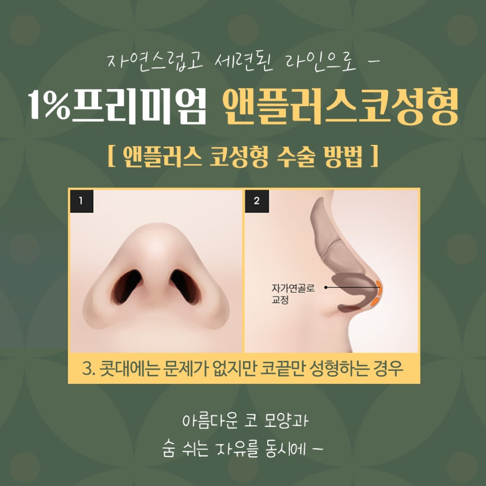 자가늑연골코수술 기능까지 생각해서 관련 이미지 11