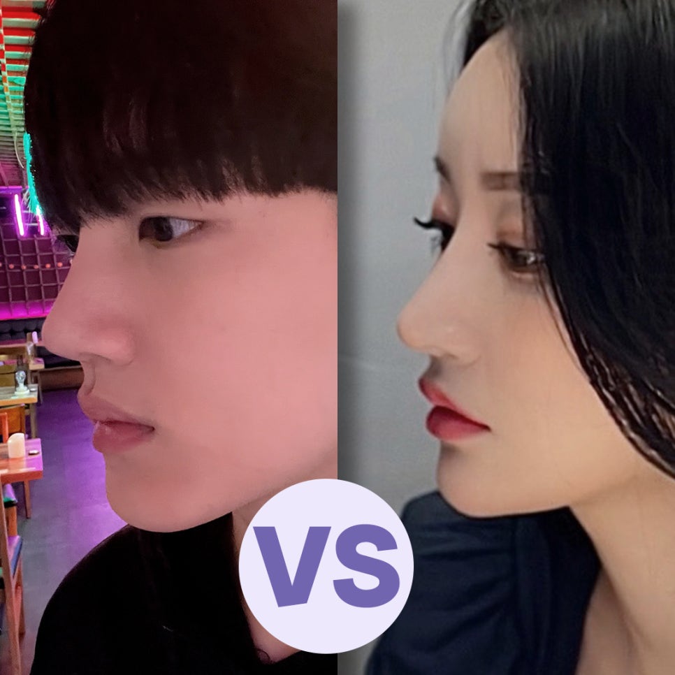 남자성형 자연스럽고 멋있게 관련 이미지 10