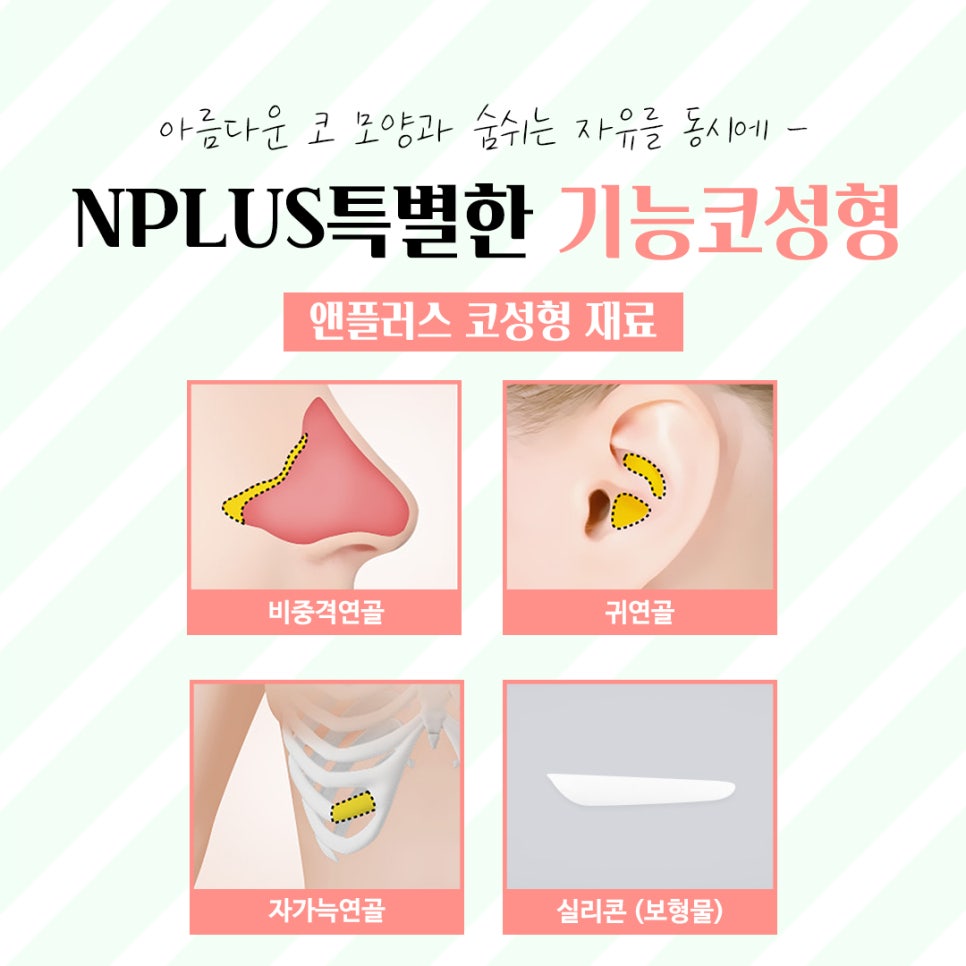 코성형후기 제대로 알아보고 관련 이미지 9