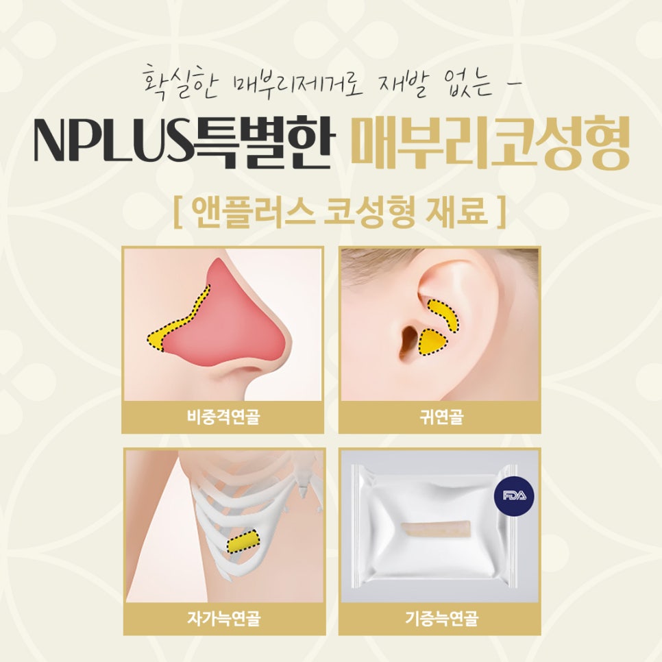매부리코수술후기 확인하고 부드러운 인상으로 관련 이미지 13