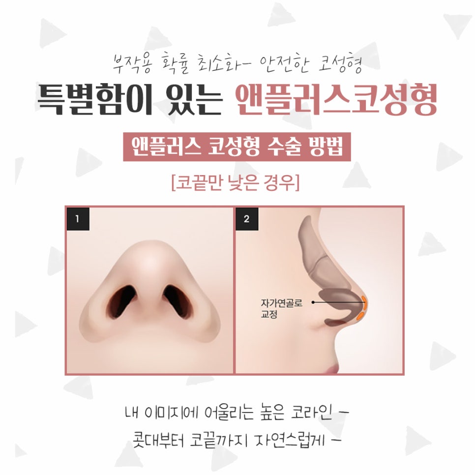 Before and After Female Nose Surgery for a Satisfying Result image 10