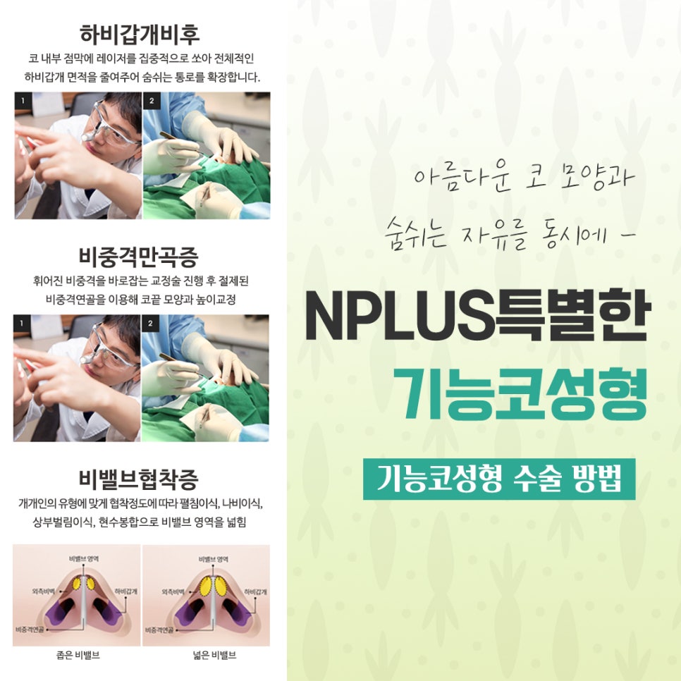 기능코수술후기에 대한 내용을 비교하여 관련 이미지 9