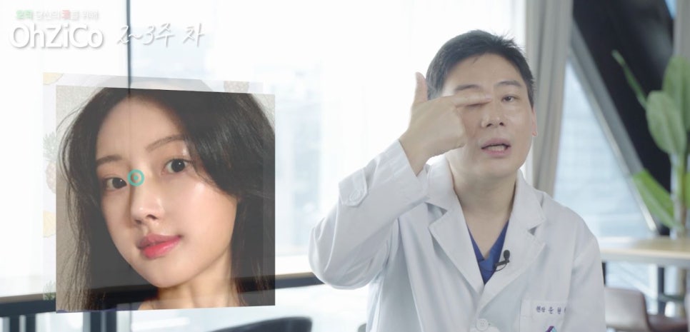 짧은코수술 후기까지 자세하게 알아보고 관련 이미지 24
