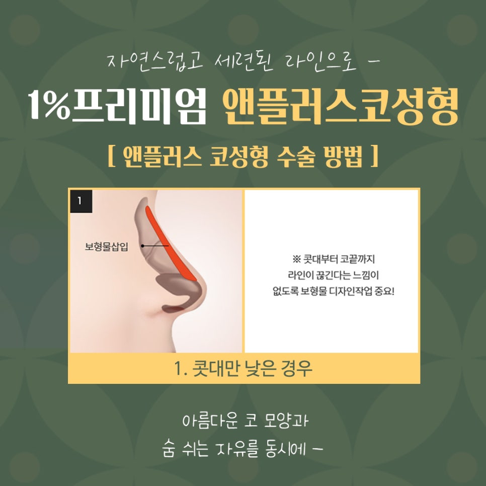 자가늑연골코수술 기능까지 생각해서 관련 이미지 10