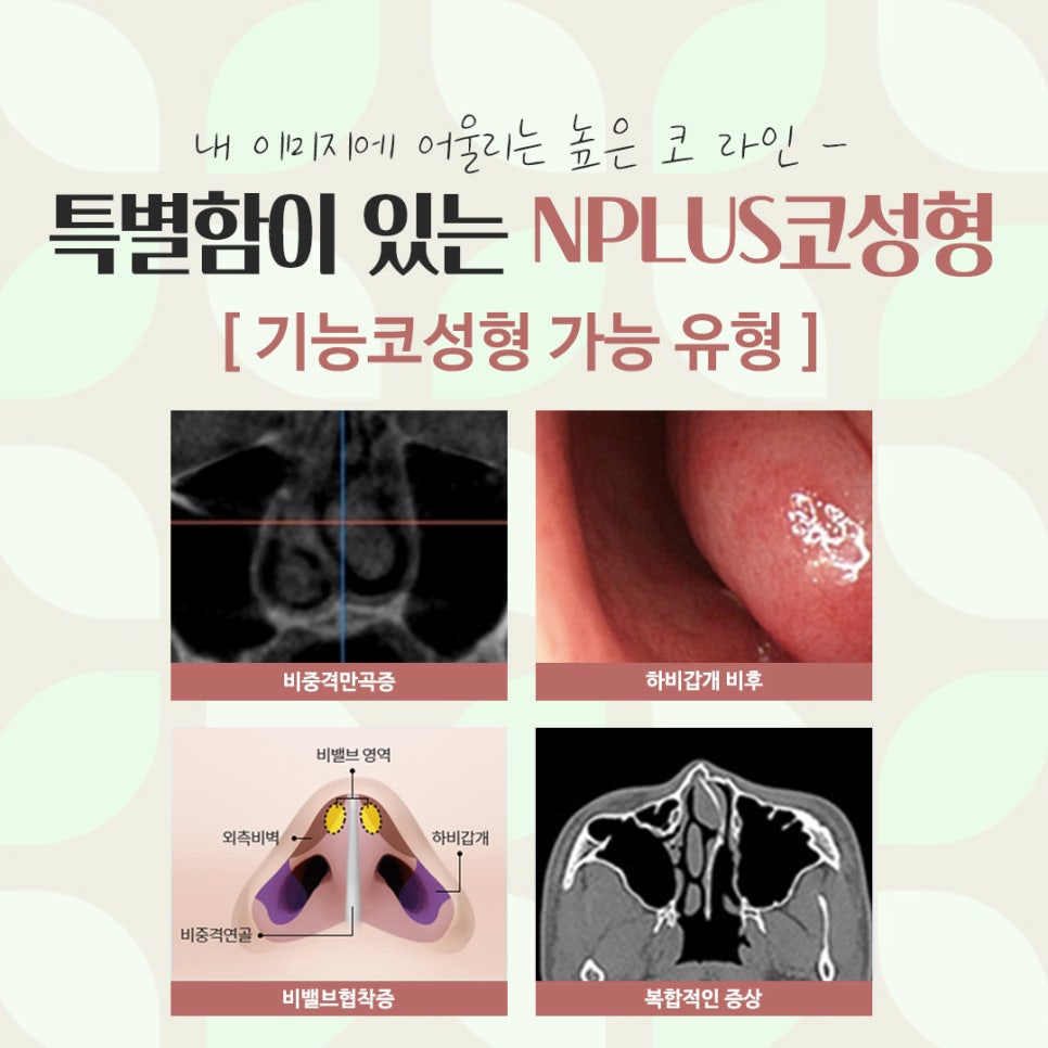 Check the Detailed Nose Surgery Review image 5