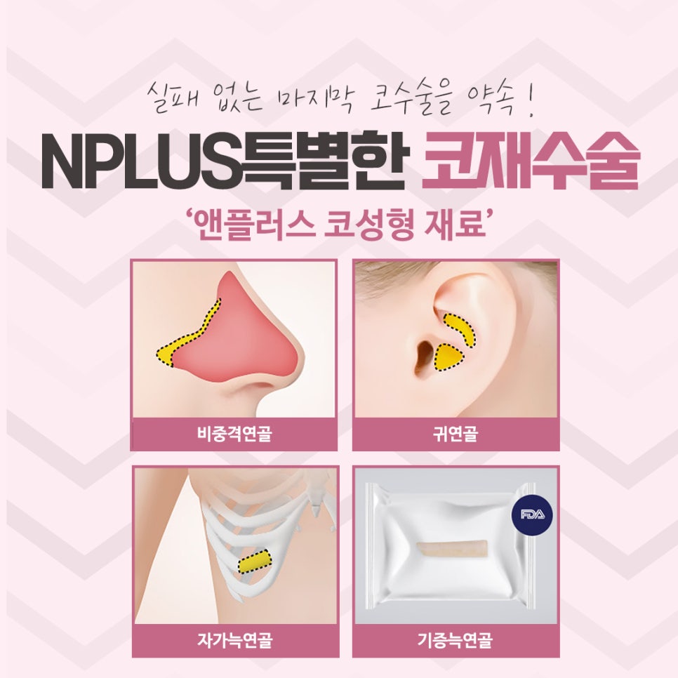 Review of Revision Rhinoplasty: Exploring Various Aspects image 10