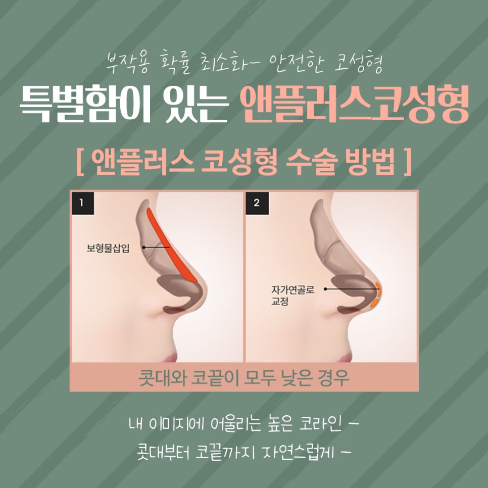 Beautiful and Natural with Autologous Cartilage Rhinoplasty image 8